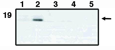 Western blot analysis
using mAnti-p21WAF-1
antibody at 10 μg/ml on
HCT116 cells (1), HCT116
cells p53-induced with
adriamycin (ADR) (2),
P21-/- cells (3), p21-/-
cells p53-induced with
ADR (4) and p53-/- cells
p53-induced with ADR
(5).